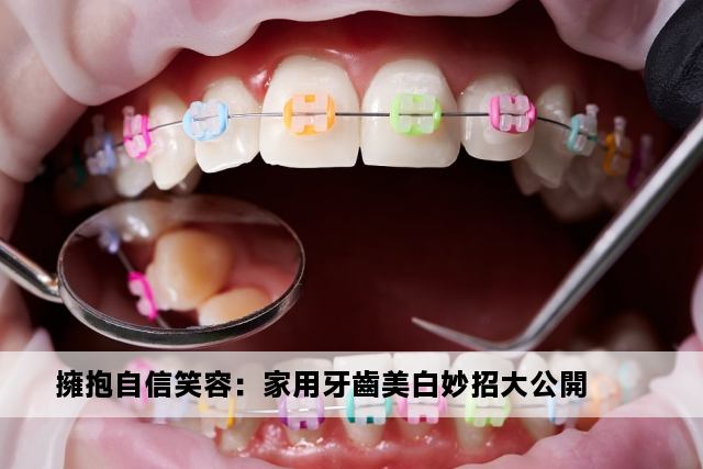 擁抱自信笑容：家用牙齒美白妙招大公開