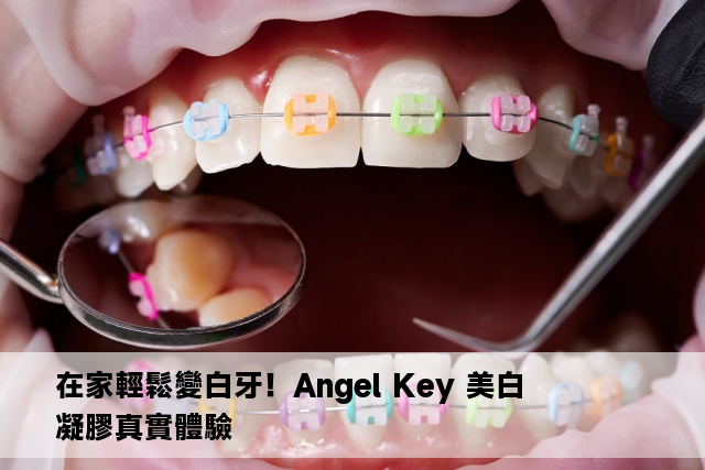 在家輕鬆變白牙！Angel Key 美白凝膠真實體驗