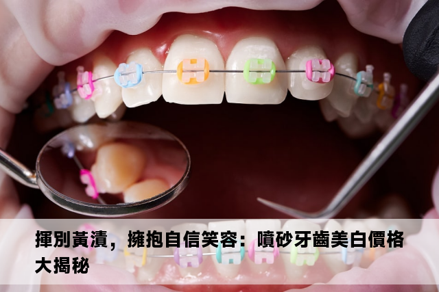 揮別黃漬，擁抱自信笑容：噴砂牙齒美白價格大揭秘