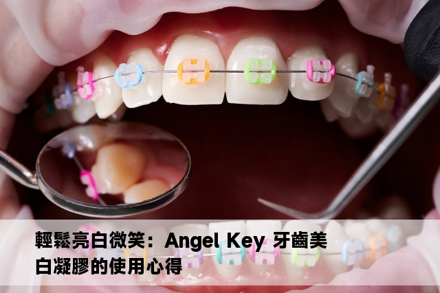 輕鬆亮白微笑：Angel Key 牙齒美白凝膠的使用心得