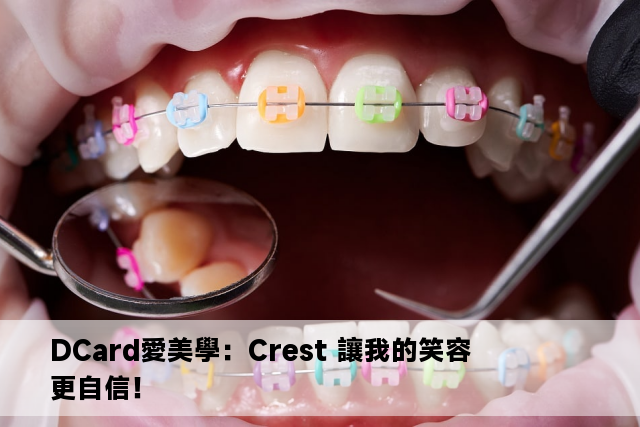 DCard愛美學：Crest 讓我的笑容更自信！