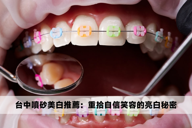 台中噴砂美白推薦：重拾自信笑容的亮白秘密