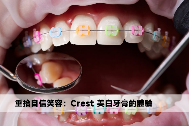 重拾自信笑容：Crest 美白牙膏的體驗