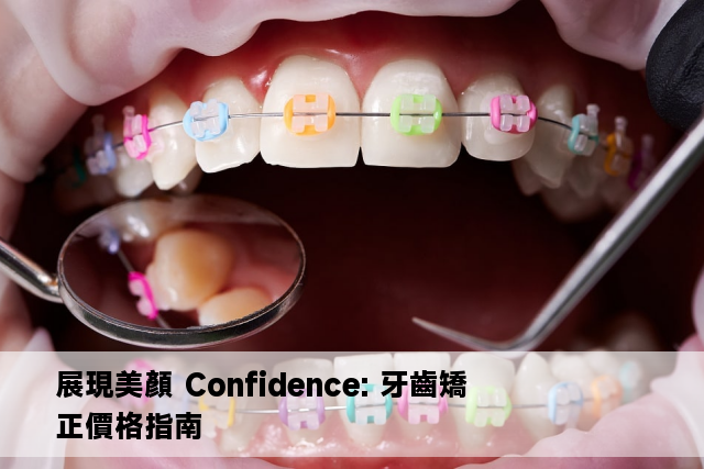 展現美顏 Confidence: 牙齒矯正價格指南