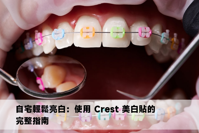 自宅輕鬆亮白：使用 Crest 美白貼的完整指南