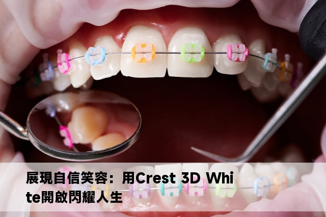 展現自信笑容：用Crest 3D White開啟閃耀人生