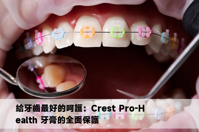 給牙齒最好的呵護：Crest Pro-Health 牙膏的全面保護