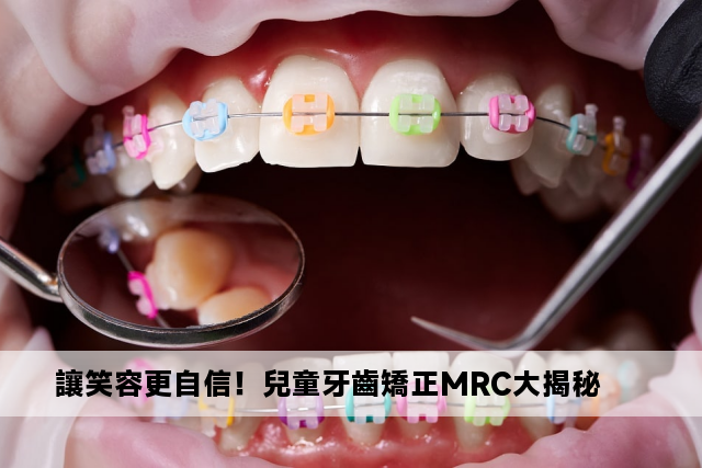 讓笑容更自信！兒童牙齒矯正MRC大揭秘