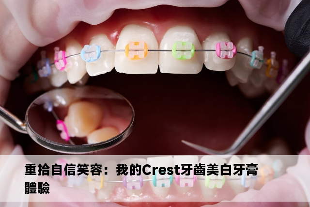 重拾自信笑容：我的Crest牙齒美白牙膏體驗