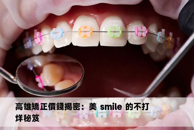 高雄矯正價錢揭密：美 smile 的不打烊秘笈