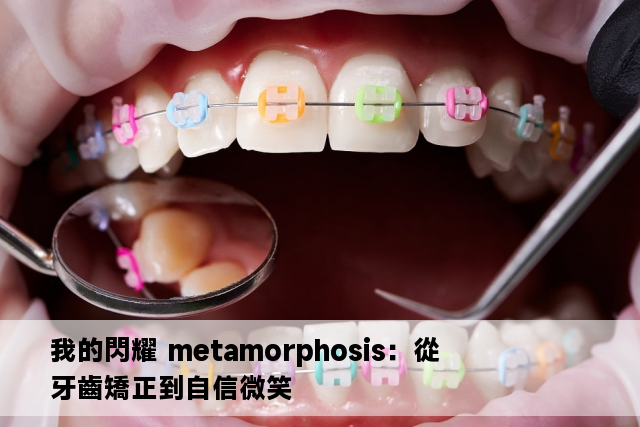 我的閃耀 metamorphosis：從牙齒矯正到自信微笑