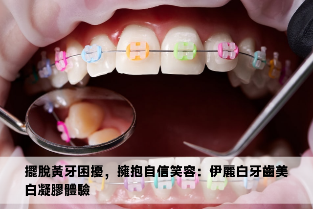 擺脫黃牙困擾，擁抱自信笑容：伊麗白牙齒美白凝膠體驗