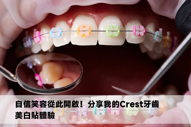 自信笑容從此開啟！分享我的Crest牙齒美白貼體驗