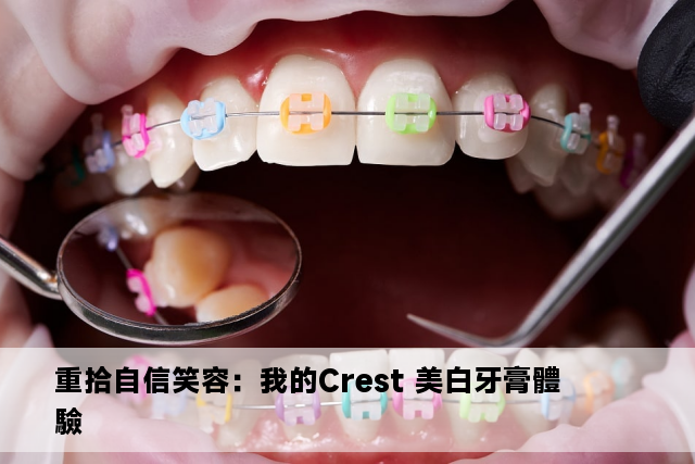 重拾自信笑容：我的Crest 美白牙膏體驗