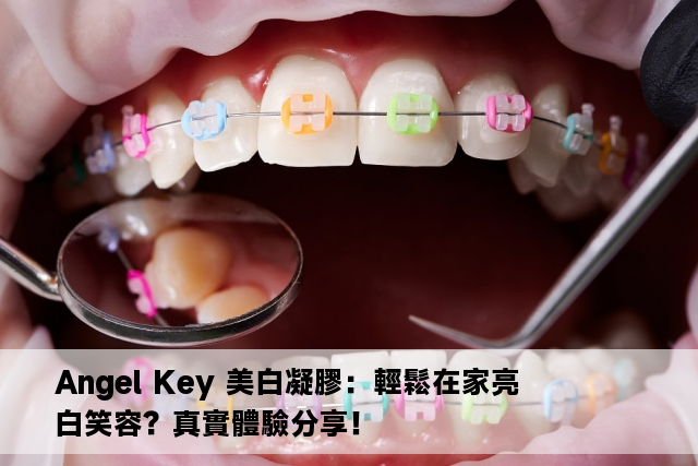 Angel Key 美白凝膠：輕鬆在家亮白笑容？真實體驗分享！