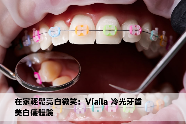 在家輕鬆亮白微笑：Viaila 冷光牙齒美白儀體驗