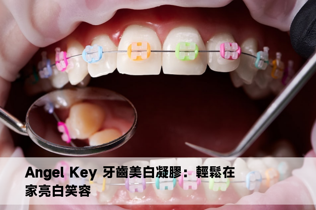 Angel Key 牙齒美白凝膠：輕鬆在家亮白笑容