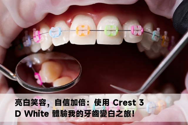 亮白笑容，自信加倍：使用 Crest 3D White 體驗我的牙齒變白之旅！