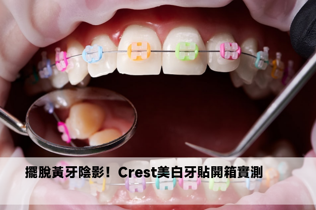 擺脫黃牙陰影！Crest美白牙貼開箱實測 