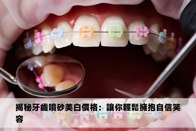 揭秘牙齒噴砂美白價格：讓你輕鬆擁抱自信笑容 