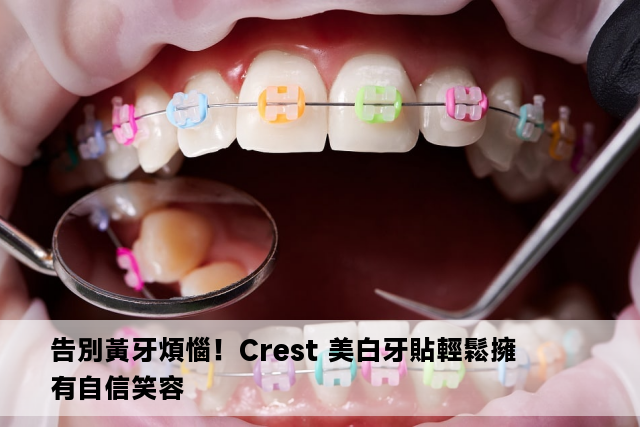 告別黃牙煩惱！Crest 美白牙貼輕鬆擁有自信笑容