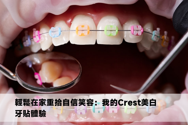 輕鬆在家重拾自信笑容：我的Crest美白牙貼體驗