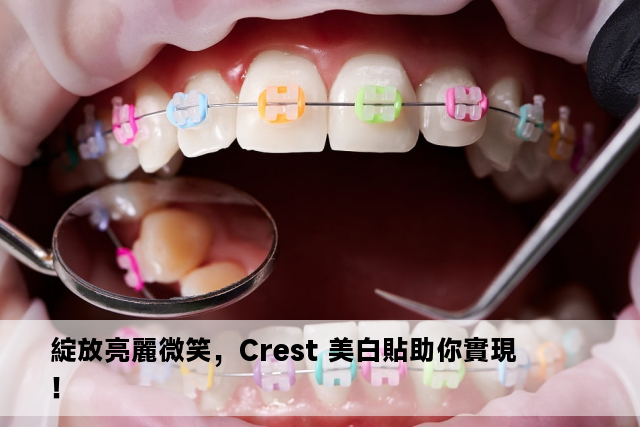 綻放亮麗微笑，Crest 美白貼助你實現！